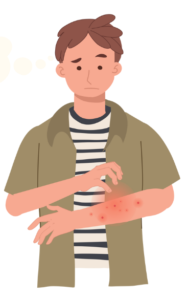 Illustration d'un homme se grattant le bras en raison de piqûres de punaises de lit.