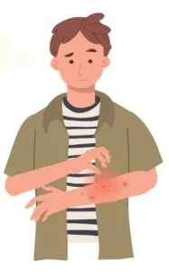 Illustration d'un homme se grattant le bras en raison de piqûres de punaises de lit.
