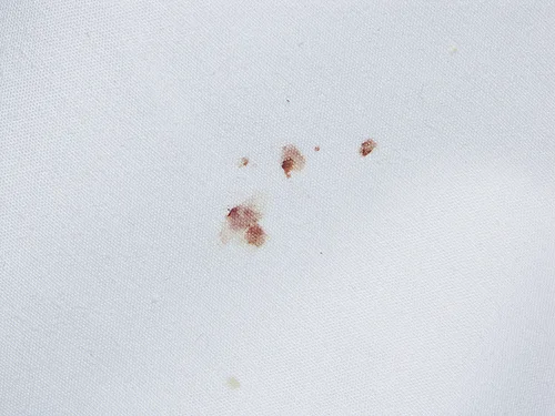 Taches de sang caractéristiques des punaises de lit sur un drap blanc.