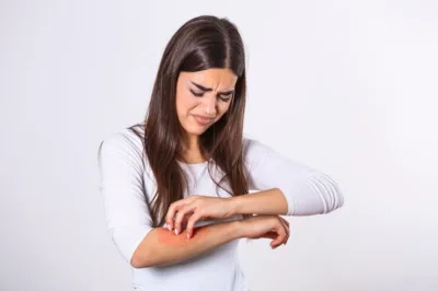 Femme se grattant le bras à cause de piqûres de punaises de lit