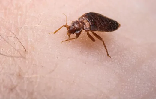 Grosse punaise de lit sur la peau d’un humain – image d’infestation active